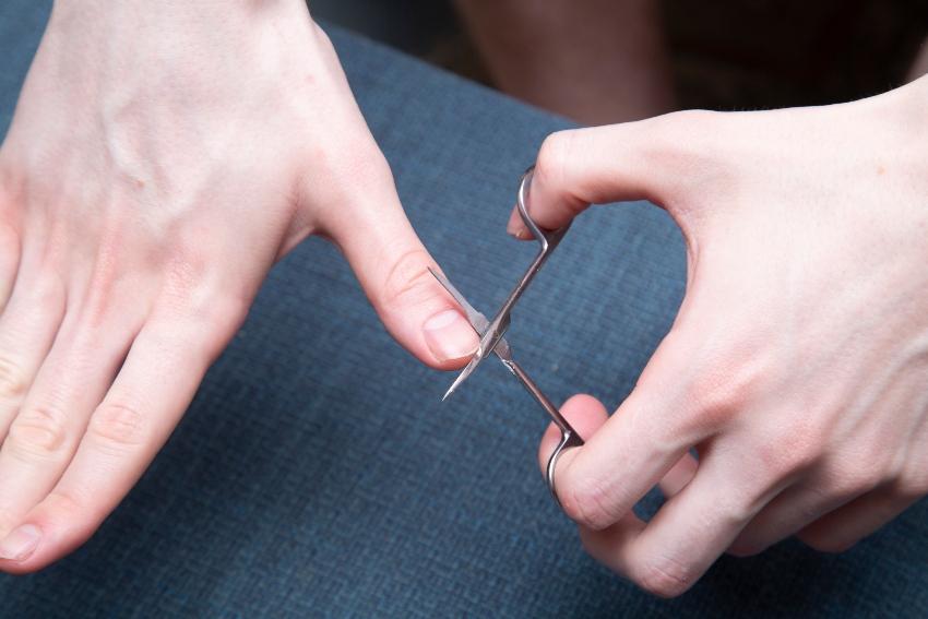 Abschneiden der Nagelhaut 